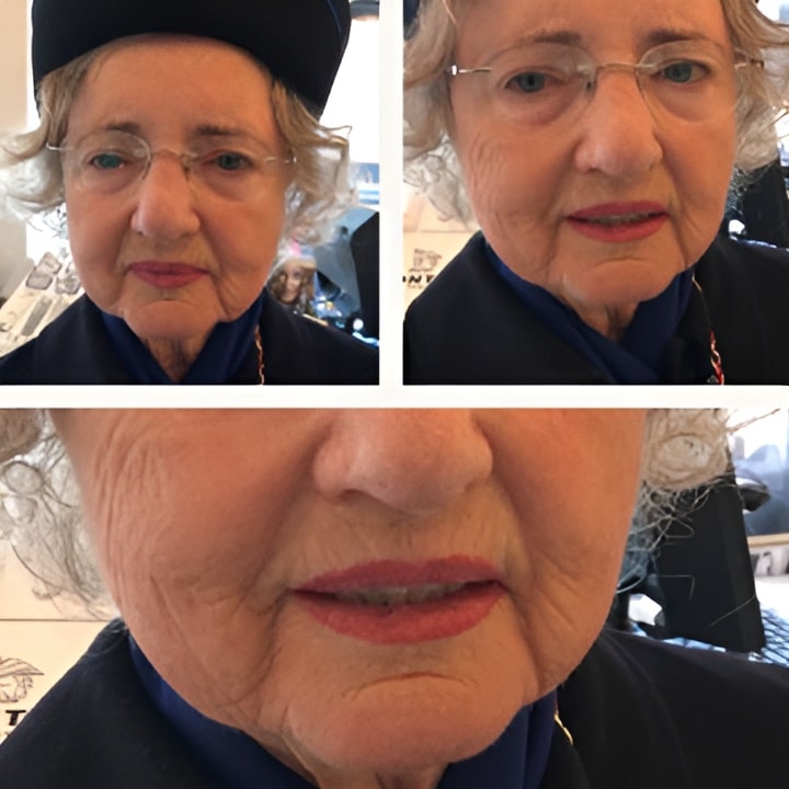 Permanent makeup - Læbekant