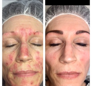 Microblading og permanent makeup