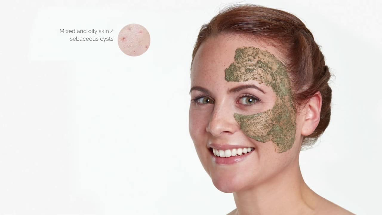 Green Peel behandling I Vejle