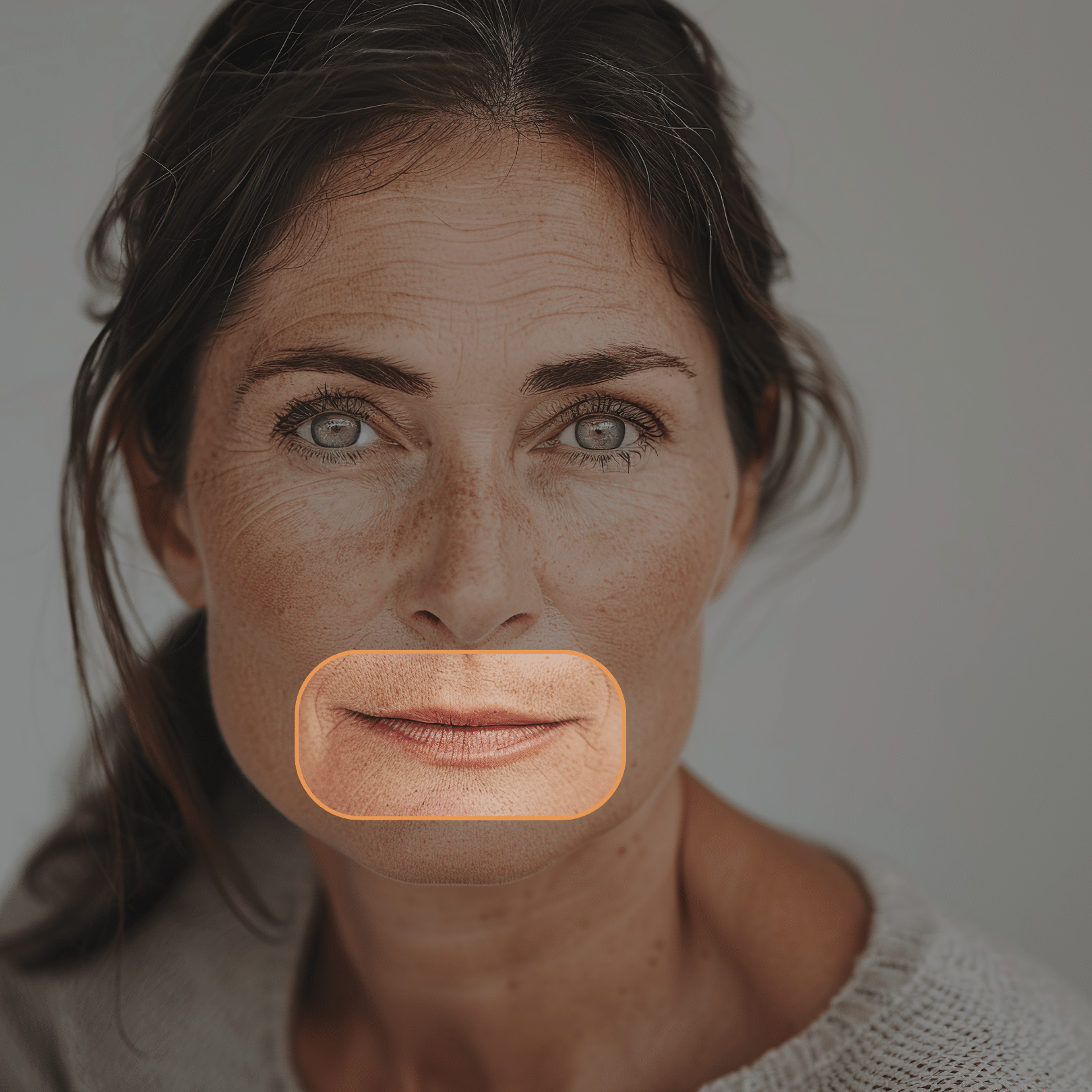 Meso Lip Volume